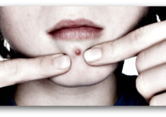 Credit Blemish Removal